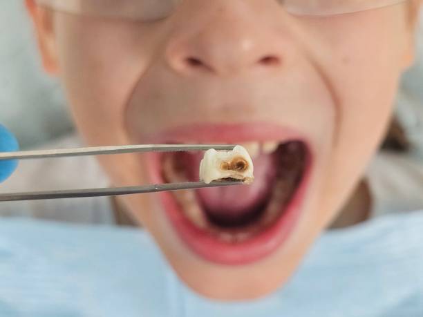 Best Pediatric Emergency Dentist in Ithaca, MI